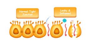 Leaky-gut-syndrome pic 2 - gut-brain