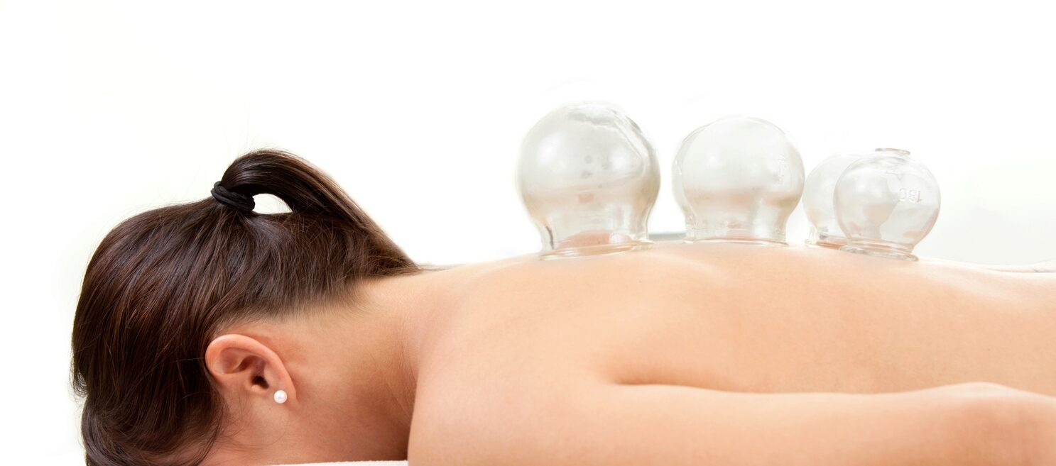 Cupping-Therapy