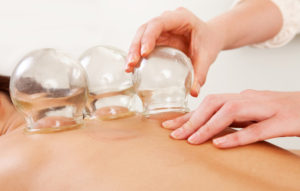 cupping-therapy